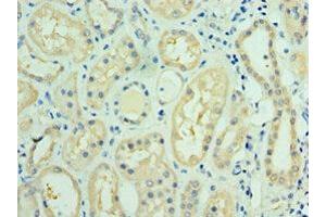 Immunohistochemistry of paraffin-embedded human kidney tissue using ABIN7143736 at dilution of 1:100
