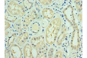 Immunohistochemistry of paraffin-embedded human kidney tissue using ABIN7143736 at dilution of 1:100 (FUT6 anticorps  (AA 170-359))