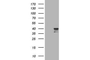 Image no. 1 for anti-Sialidase 1 (Lysosomal Sialidase) (NEU1) (AA 48-315) antibody (ABIN1491550) (NEU1 anticorps  (AA 48-315))