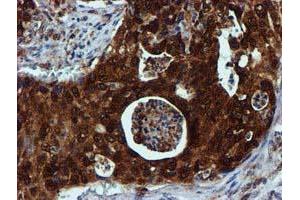 Image no. 3 for anti-Sepiapterin Reductase (SPR) antibody (ABIN1501115)