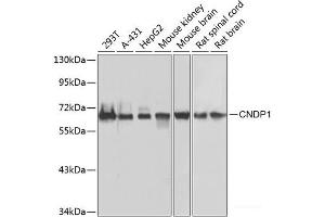Western blot analysis of extracts of various cell lines using CNDP1 Polyclonal Antibody at dilution of 1:1000. (CNDP1 anticorps)