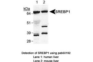 Image no. 1 for anti-Sterol Regulatory Element Binding Transcription Factor 1 (SREBF1) (AA 300-400) antibody (ABIN363501)
