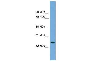 WB Suggested Anti-PSME2 Antibody Titration: 0. (PSME2 anticorps  (Middle Region))