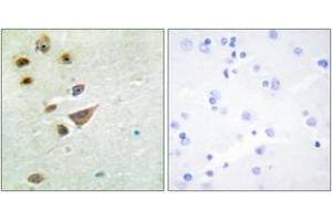 Immunohistochemistry analysis of paraffin-embedded human brain tissue, using NT5C3 Antibody.