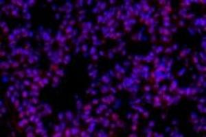 Immunofluorescent analysis of paraformaldehyde-fixed mouse lung usingp38IP (ABIN7075954) at dilution of 1: 400 (Transcription Factor SPT20 Homolog (SUPT20H) anticorps)