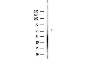 Western blot analysis of lysates from HepG2 cells(LPS, 4h treatment), using CHRN Antibody at 1/1000 dilution.