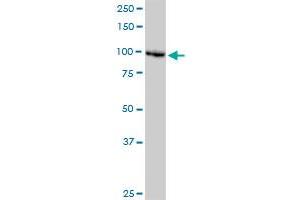 DDX11 monoclonal antibody (M03), clone 3C1.