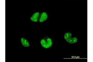 Immunofluorescence of monoclonal antibody to ESR2 on HeLa cell.