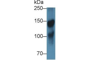 Western blot analysis of Pig Cerebrum lysate, using Rabbit Anti-Human ICAM5 Antibody (1 µg/ml) and HRP-conjugated Goat Anti-Rabbit antibody (abx400043, 0. (ICAM5 anticorps  (AA 409-674))