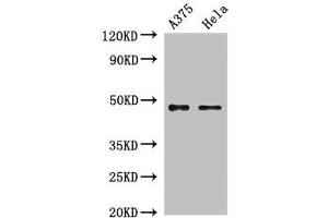 Western Blot Positive WB detected in: A375 whole cell lysate, Hela whole cell lysate All lanes: RPL4 antibody at 2 μg/mL Secondary Goat polyclonal to rabbit IgG at 1/50000 dilution Predicted band size: 48 kDa Observed band size: 48 kDa (RPL4 anticorps  (AA 12-91))