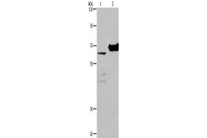 Western Blotting (WB) image for anti-Choline Dehydrogenase (CHDH) antibody (ABIN2423153) (CHDH anticorps)