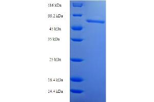 SDS-PAGE (SDS) image for Fibroblast Growth Factor (Acidic) Intracellular Binding Protein (FIBP) (AA 2-357) protein (His-SUMO Tag) (ABIN5709527)