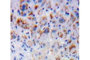 Used in DAB staining on fromalin fixed paraffin-embedded Liver tissue (CD1d anticorps  (AA 32-302))
