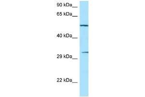 WB Suggested Anti-NCR1 Antibody Titration: 1. (NCR1 anticorps  (C-Term))
