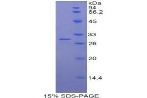 SDS-PAGE analysis of Human Myosin IG Protein. (MYO1G Protéine)