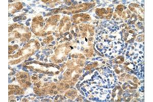 GCNT3 antibody was used for immunohistochemistry at a concentration of 4-8 ug/ml.