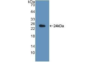 Detection of Recombinant LMP7, Rat using Polyclonal Antibody to Large Multifunctional Peptidase 7 (LMP7)
