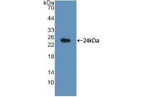 Detection of Recombinant LMP7, Rat using Polyclonal Antibody to Large Multifunctional Peptidase 7 (LMP7) (PSMB8 anticorps  (AA 80-261))
