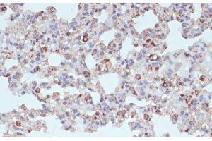 Immunohistochemistry of paraffin-embedded Rat lung using PDGFR beta Polyclonal Antibody at dilution of 1:100 (40x lens). (PDGFRB anticorps)