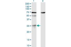 Western Blot analysis of TWSG1 expression in transfected 293T cell line by TWSG1 monoclonal antibody (M01), clone 6E6. (TWSG1 anticorps  (AA 124-223))
