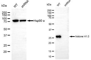 Western blotting analysis using histone H1. (Recombinant Histone H1 anticorps)