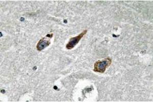 Immunohistochemistry (IHC) analyzes of Annexin II antibody in paraffin-embedded human brain tissue. (Annexin A2 anticorps)