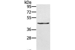 Western Blot analysis of A549 cell using KRT31 Polyclonal Antibody at dilution of 1:500 (Keratin 31 anticorps)