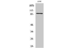 Western Blotting (WB) image for anti-Chloride Channel, Voltage-Sensitive 7 (CLCN7) (N-Term) antibody (ABIN3174436) (CLCN7 anticorps  (N-Term))
