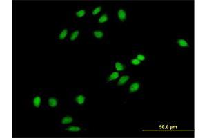 Immunofluorescence of purified MaxPab antibody to PCOLN3 on HeLa cell. (CHMP1A anticorps  (AA 1-196))