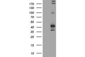 Image no. 2 for anti-Fc Fragment of IgE, Low Affinity II, Receptor For (CD23) (FCER2) (AA 48-321) antibody (ABIN1491554) (FCER2 anticorps  (AA 48-321))