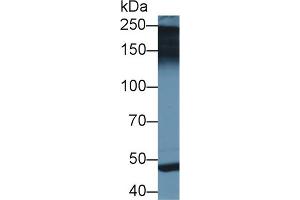 Western blot analysis of Rat Placenta lysate, using Human PAPPA2 Antibody (2 µg/ml) and HRP-conjugated Goat Anti-Rabbit antibody ( (PAPPA2 anticorps  (AA 888-1093))