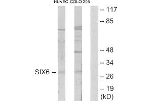 Western blot analysis of extracts from HUVEC cells and COLO205 cells, using SIX6 antibody. (SIX Homeobox 6 anticorps  (Internal Region))