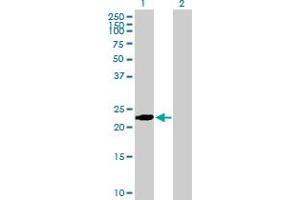 Western Blot analysis of BIN3 expression in transfected 293T cell line by BIN3 MaxPab polyclonal antibody. (BIN3 anticorps  (AA 1-199))