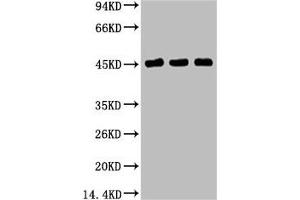 Western blot analysis of 1) Hela, 2) MCF7, 3) 293T, diluted at 1:2000.