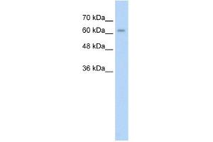 WB Suggested Anti-ALPPL2 Antibody Titration:  2. (ALPPL2 anticorps  (N-Term))
