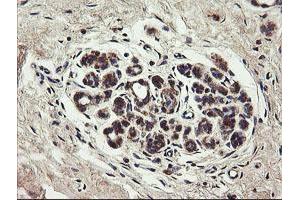 Image no. 2 for anti-Ubiquitin-Conjugating Enzyme E2, J1, U (UBE2J1) antibody (ABIN1501638)