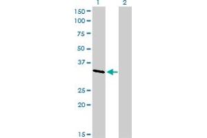 Western Blot analysis of CRKL expression in transfected 293T cell line by CRKL monoclonal antibody (M03), clone 4B5.