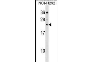 MED19 Antibody (C-term) (ABIN1536757 and ABIN2850102) western blot analysis in NCI- cell line lysates (35 μg/lane). (MED19 anticorps  (C-Term))