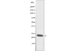 Western blot analysis of extracts from RAW264.