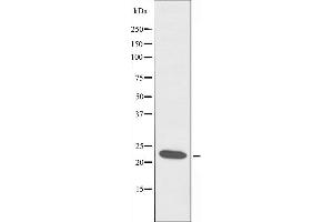 Western blot analysis of extracts from RAW264. (CIDEB anticorps  (Internal Region))