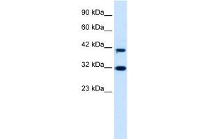 WB Suggested Anti-DPF1 Antibody Titration:  0. (DPF1 anticorps  (Middle Region))