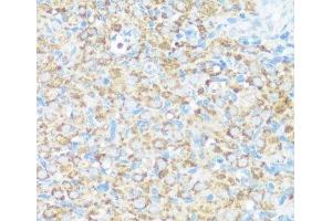 Immunohistochemistry of paraffin-embedded Rat ovary using NMT1 Polyclonal Antibody at dilution of 1:100 (40x lens). (NMT1 anticorps)