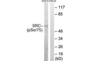 Western blot analysis of extracts from COLO205 cells treated with EGF 200ng/ml 30', using Src (Phospho-Ser75) Antibody. (Src anticorps  (pSer75))