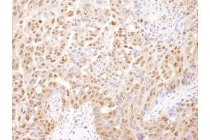 Immunohistochemistry (IHC) image for anti-Proteasome Subunit alpha 2 (PSMA2) (AA 184-234) antibody (ABIN7454564) (PSMA2 anticorps  (AA 184-234))