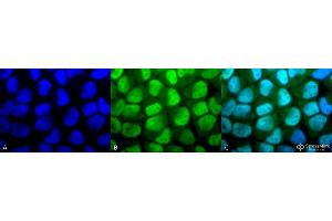 Immunocytochemistry/Immunofluorescence analysis using Rabbit Anti-Methylated Lysine Polyclonal Antibody . (Lysine (lys) (methylated) anticorps (HRP))