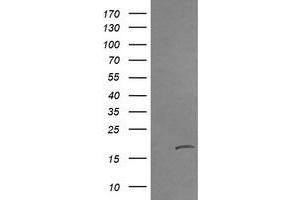 Image no. 2 for anti-Cancer/testis Antigen 1B (CTAG1B) antibody (ABIN1499893) (CTAG1B anticorps)