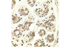 Immunohistochemistry of paraffin-embedded human breast using PRPF3 Antibody (ABIN5973192) at dilution of 1/100 (40x lens). (PRPF3 anticorps)