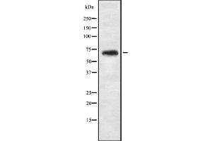 Western blot analysis of NBPF4 expression in 293T whole cell lysate ,The lane on the left is treated with the antigen-specific peptide.