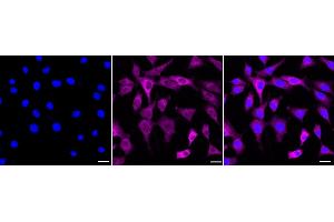 Immunocytochemical staining of C2C12 cells with Phospho-MEK1 (S298) antibody (ABIN7799462), 1:1,000). (Recombinant MEK1 anticorps  (pSer298))