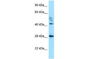 WB Suggested Anti-ATCAY Antibody Titration: 1.